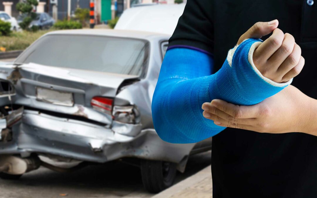 Reasons to Hire a Personal Injury Lawyer After an Accident